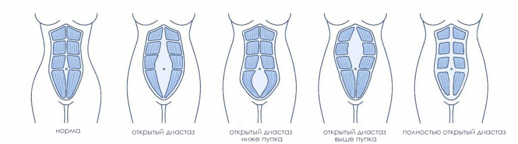 diastaz.jpg